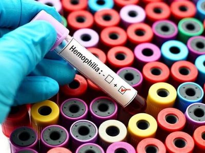 کانون هموفیلی زاهدان امید بیماران در دل محرومیت